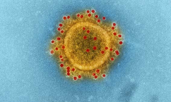 coronavirus covid 19